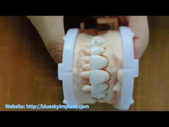 Vương miện Zirconia với đồ trang sức