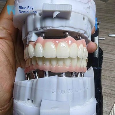 Mua Lớp cấy ghép Zirconia tùy chỉnh Full Arch Case online manufacture