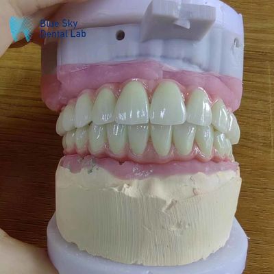 Mua Khả năng tương thích toàn cầu Cầu Malo kim loại với khung Titanium tinh khiết online manufacture