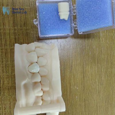 Mua Địa hình thẩm mỹ Zirconia Cải tạo răng Zirconia Vương miện sứ online manufacture