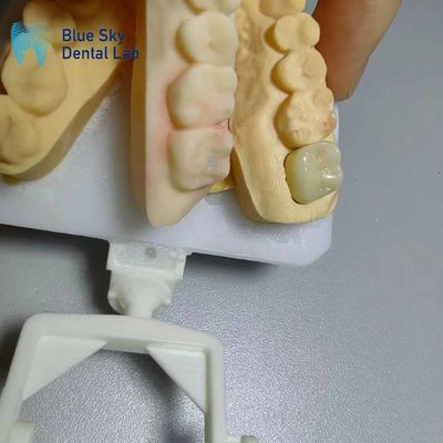 Mua Tương kháng ăn mòn Zirconia vương miện trông tự nhiên Zirconia răng online manufacture