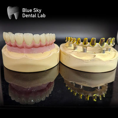Mua Vít giữ MUA đệm cấy ghép trường hợp Zirconia vương miện đa lớp sứ hồng với sửa chữa dễ dàng online manufacture