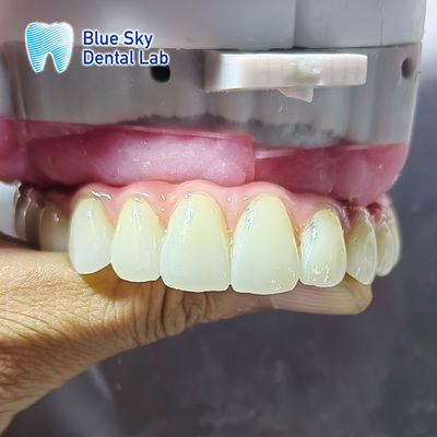 Mua Các trường hợp cấy ghép cho nhiều hệ thống cấy ghép online manufacture