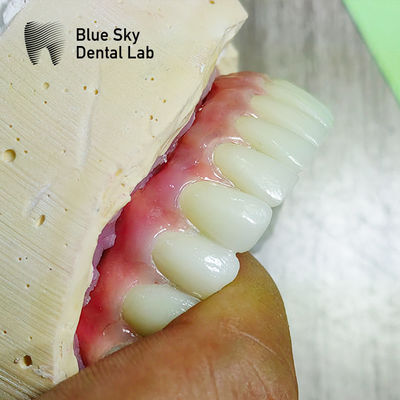 Mua Nature Bề mặt Toàn cầu tương thích Nhiều lựa chọn Các trường hợp hoạt động cấy ghép để khử trùng bằng hơi nước online manufacture
