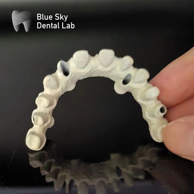 Mua Titanium Frame Malo Bridge Dental Custom Malo Implant Bridge online manufacture