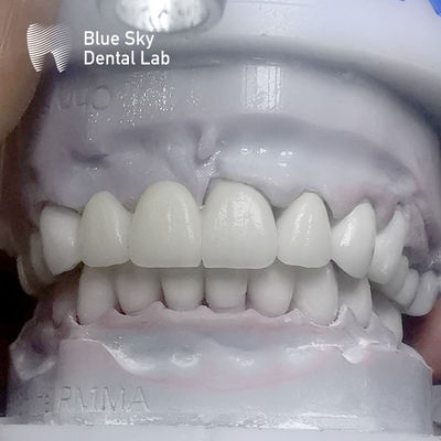 Mua Ràng lớp Zirconia răng nhiều lớp trước khi kính online manufacture