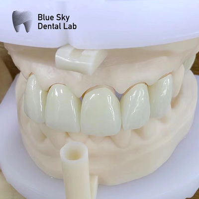 Mua Vẻ đẹp tự nhiên nhiều lớp vương miện Zirconia Độ bền cao Kháng hóa học online manufacture