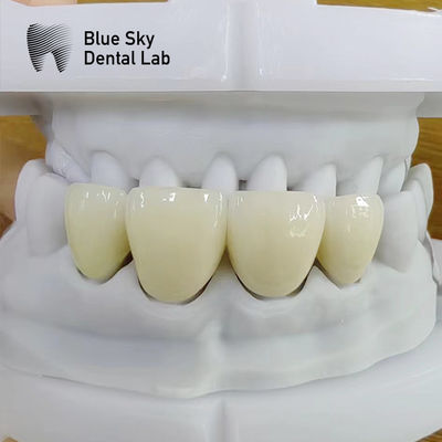 Mua Nhìn tự nhiên Lớp Zirconia Sức mạnh cao Lớp Zircon đa hình chữ nhật online manufacture