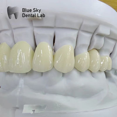 Mua Vương miện Zirconia lớp xuyên suốt phục hồi răng nhiều lớp Vương miện Zirconia online manufacture