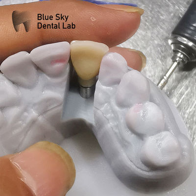 Mua Nghiên cứu tương thích sinh học Kịch bản cấy ghép Khử trùng bằng hơi nước online manufacture