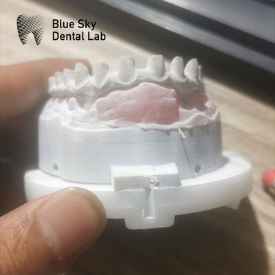 Mua Cây cầu Malo công nghiệp tùy chỉnh trong bạc và vàng Malo cấy ghép cây cầu online manufacture