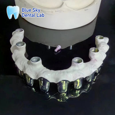 Mua Titanium tinh khiết Malo Bridge tùy chỉnh răng khung kim loại bạc online manufacture
