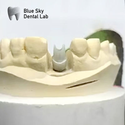 Mua Thiết bị cấy ghép Aesthetic Zirconia Abutment Biocompatible Precision Milled online manufacture
