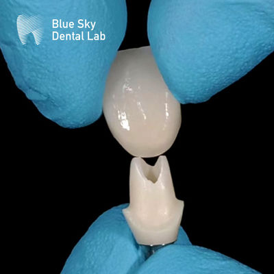 Mua Quét bằng miệng Custom Zirconia Abutment online manufacture