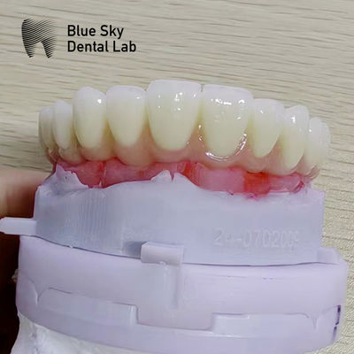 Mua Các trường hợp thủ tục cấy ghép tự nhiên với khả năng tương thích phổ quát và hiệu suất tối ưu online manufacture