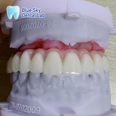 Mua Tùy chỉnh màu sắc bề mặt mượt mà cấy ghép dụng cụ trường hợp online manufacture