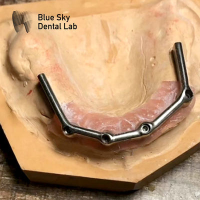 Mua Toàn bộ răng trên thanh titan Toàn bộ miệng phục hồi Blue Sky cấy ghép online manufacture