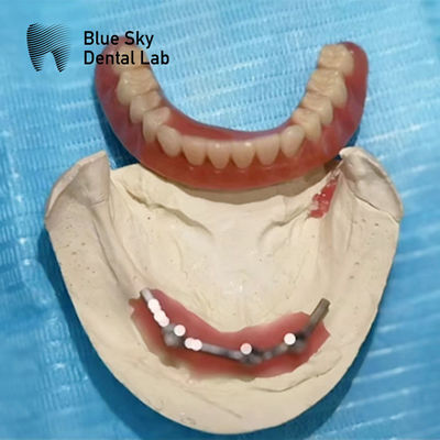 Mua Blue Sky Implant Titanium Bar Dental Cho răng giả cấy ghép online manufacture