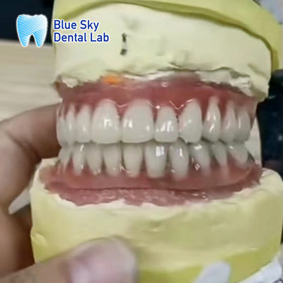 Mua Toàn bộ thanh Titanium trên và dưới Blue Sky cấy ghép răng online manufacture