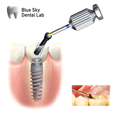 Mua Nội bộ Hex ASC Abutment điều chỉnh góc nghiêng đường ống vít online manufacture