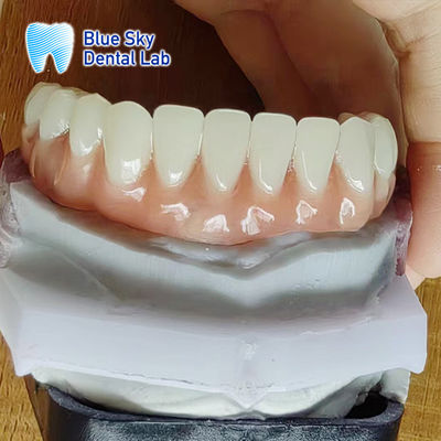Mua Denture Acrylic đầy đủ thoải mái nhìn tự nhiên Acrylic nhựa răng giả online manufacture