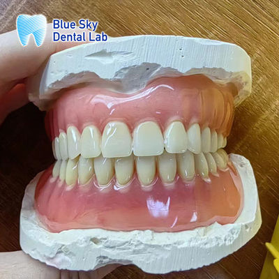 Mua Mắt bị mất Acrylic hoàn chỉnh răng giả phục hồi Acrylic hoàn chỉnh răng giả online manufacture