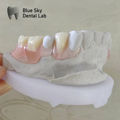 Mua Nụ cười tự nhiên răng Valplast răng giả Valplast linh hoạt răng giả có thể tháo rời online manufacture