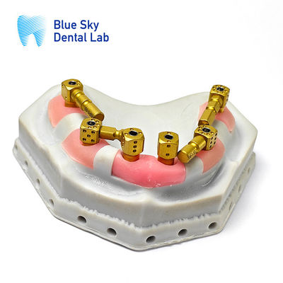 Mua Kim loại Multi Unit Abutment Scanbody Implant Multi Unit Scan Body Cho cấy ghép online manufacture