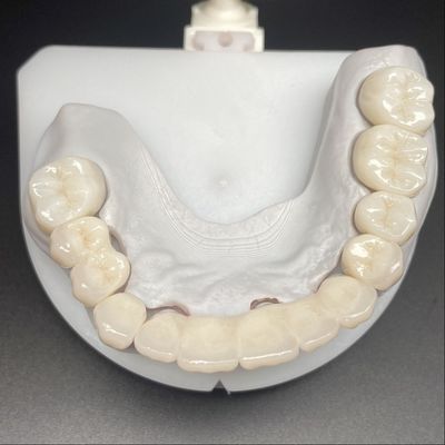 Mua Cây cầu Zirconia lớp để phục hồi cố định Nụ cười đẹp chuyên nghiệp ổn định online manufacture