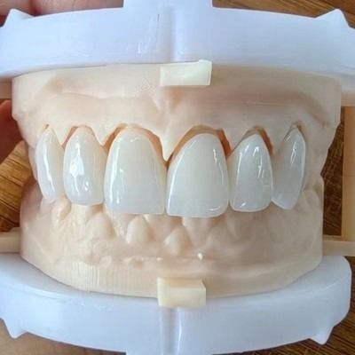 Mua Đường cầu vương miện Zirconia lớp thiên nhiên cho nụ cười đẹp và phục hồi tốt Chứng chỉ FDA và CE online manufacture