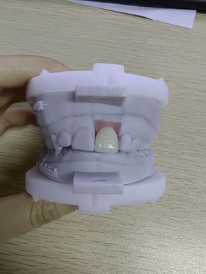 Mua Các vỏ cấy ghép bền cao có thể chứa đến 5 cấy ghép để linh hoạt giả mạo có thể tháo rời online manufacture