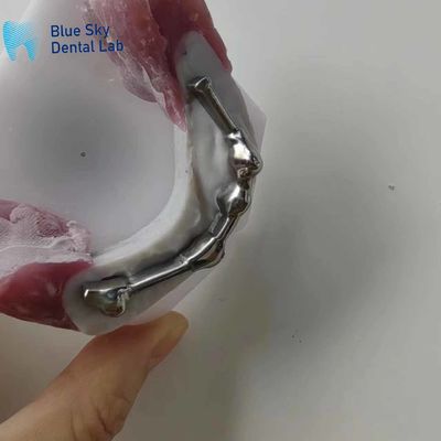 Dental Titanium Bar có thể tùy chỉnh với răng đệm cho răng giả