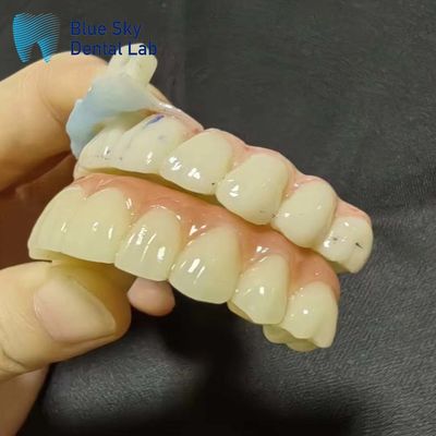 Các trường hợp cấy ghép nhân tạo Các trường hợp cấy ghép cho khả năng tương thích hệ thống liền mạch