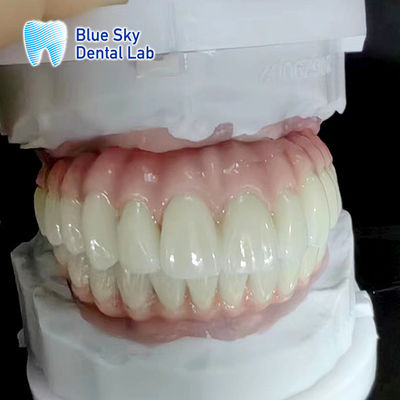 Vật liệu cấy ghép răng thông thường