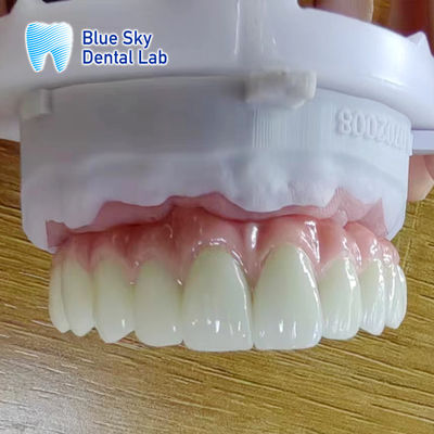 Metal Frame Titanium Malo Bridge Đường cầu cấy ghép Malo tùy chỉnh