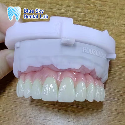 Các vỏ cấy ghép với bề mặt mượt mà cho kết quả phẫu thuật tối ưu