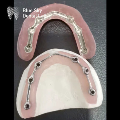 Dental Titanium Bar With Full Acrylic Denture Titanium Bar cho cấy ghép răng