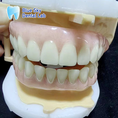 Bluesky tạm thời Acrylic răng giả một phần đầy đủ trên và dưới Acrylic răng giả