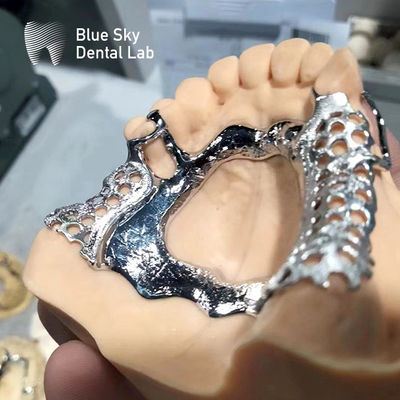 Blue Sky Dental Frame Phần hàm răng hàm ức