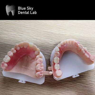 Plastic Implant Procedure Cases The Ultimate Solution for Organizing and Transporting Dental Implants