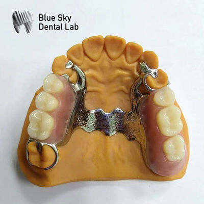 Răng đúc phần răng giả khung phần răng giả trông thật