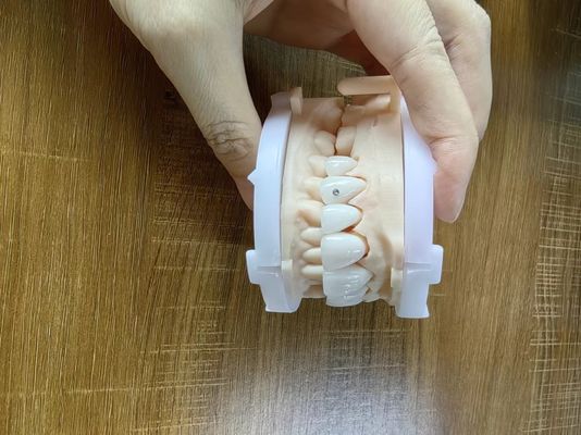 Các vương miện Zirconia rất trong suốt, các tấm vỏ cầu với đồ trang sức và vàng.