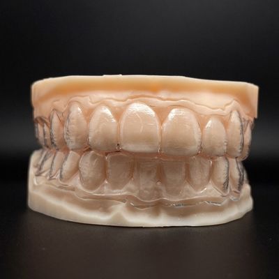 Mùi có thể tùy chỉnh, không thể nhìn thấy được, đệm răng rõ ràng với thời gian điều trị ngắn hơn